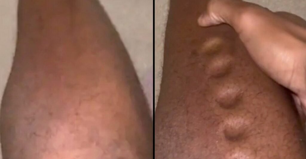 Guy Frightens Followers With Footage Of ‘Legs Turning Like Playdough’ As A Result Of Quiet Killer