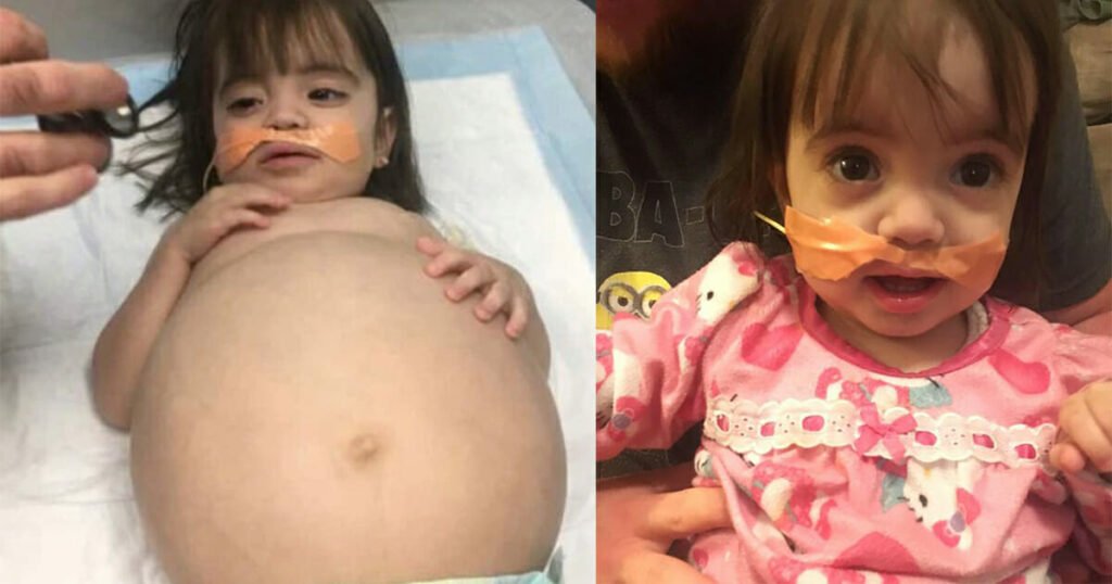 Dad saves his daughter’s life by life-saving transplant