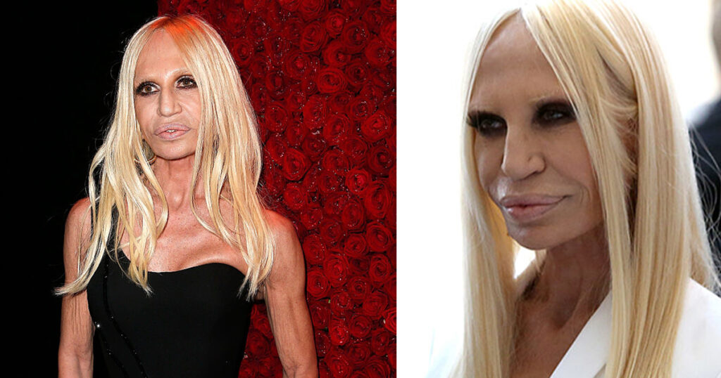 Donatella Versace’s beauty transformation