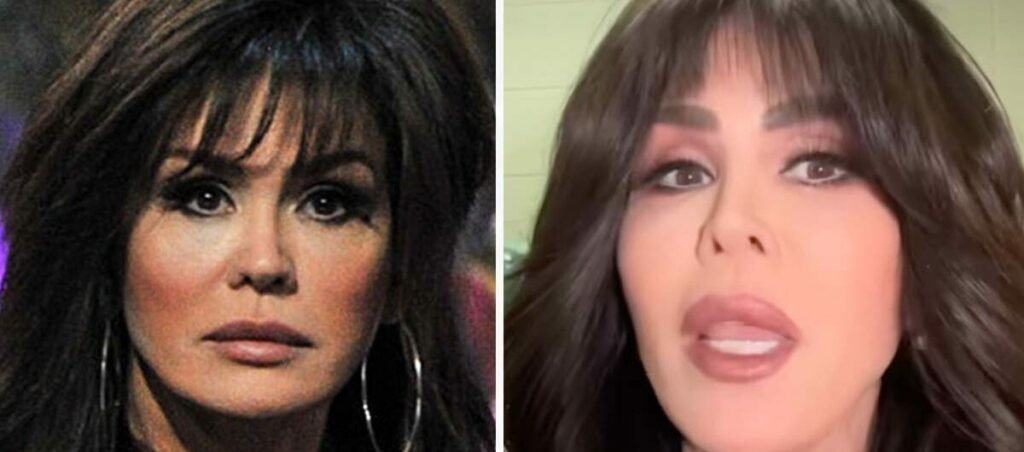 Marie Osmond accused of looking like Kim Kardashian after plastic surgery rumors