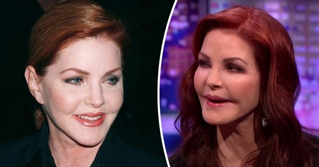 How Priscilla Presley, 77, had plastic surgery procedure gone wrong: Inside her life