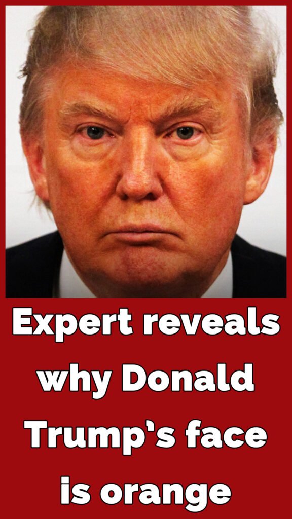 Why is Donald Trump so orange? An expert thinks she has the answer